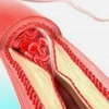 Норма холестерина в крови у женщин: разновидности жиров